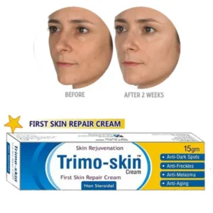 Trimo Skin Freckle Cream Tube