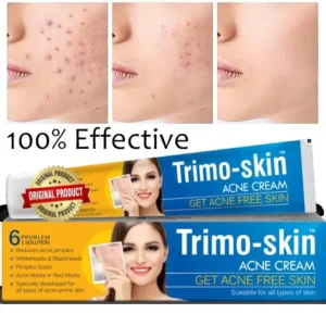 Trimo Skin Acne Cream Tube
